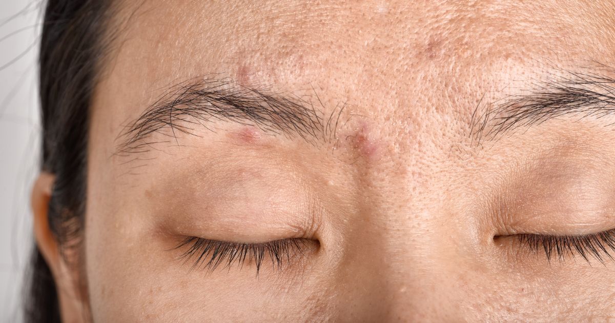 Modaskin Antiaging Moisturizing Skincare for Dry and dehydrated skin